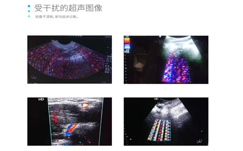 影像干擾檢測服務(wù)